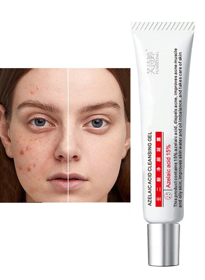 فو شيتينج جل منظف حمض الأزيليك ، حمض الأزيليك 15٪ كريم حب الشباب ، كريم حب الشباب للوجه ، علاج البقع ، جل مضاد لحب الشباب للبشرة المعرضة للبقع ، الوردية التي تقلل من تخفيف البثور ، تصبغ الرؤوس السوداء والاحمرار ، ترطيب 15 جم - Image 1