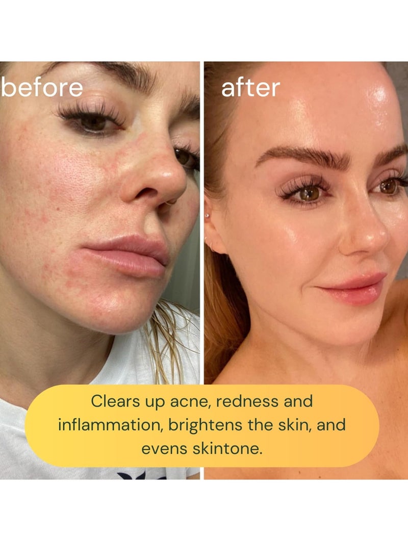 KOA LIFE KOA LIFE Vit-C Brightening Facial Cleanser - Vitamin C Facial Cleanser Wash, Skin Brightening Face Wash, Gentle Foam Cleanser, Vegan - 1.7 Fl Oz  - Image 3