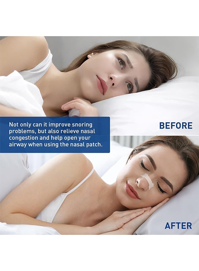 إم إكس إن مضادات الشخير شرائط الأنف, مضادات الشخير التنفس قطاع الأنف Starter Kit, Improve Sleep Quality Skin Resistat Sweat Skin Safe Nasal Strips. - Image 5