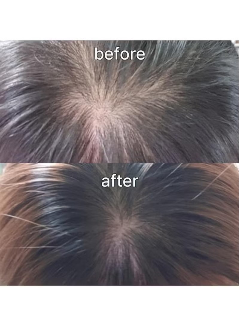 ViveLab Scalp&Hair Serum for Thinning Hair,15ml–Clinically Tested,Nourishing Formula with Biotin,peptide. Promotes Healthy Scalp&Fuller-Looking Hair - Image 4