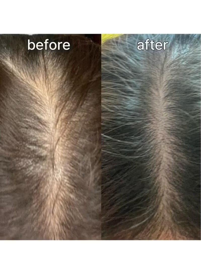 ViveLab Scalp&Hair Serum for Thinning Hair,15ml–Clinically Tested,Nourishing Formula with Biotin,peptide. Promotes Healthy Scalp&Fuller-Looking Hair - Image 5