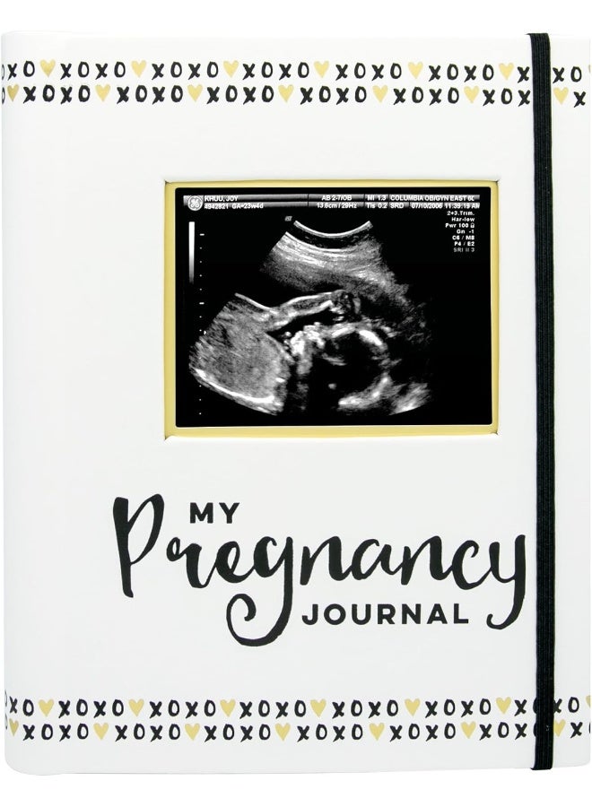 Pearhead My Pregnancy Journal, Pregnancy Keepsake Book, Newborn Milestone Memory Book, Baby Photo Album, Gender Neutral Baby Gift, 74 Fill In Pages - Image 1