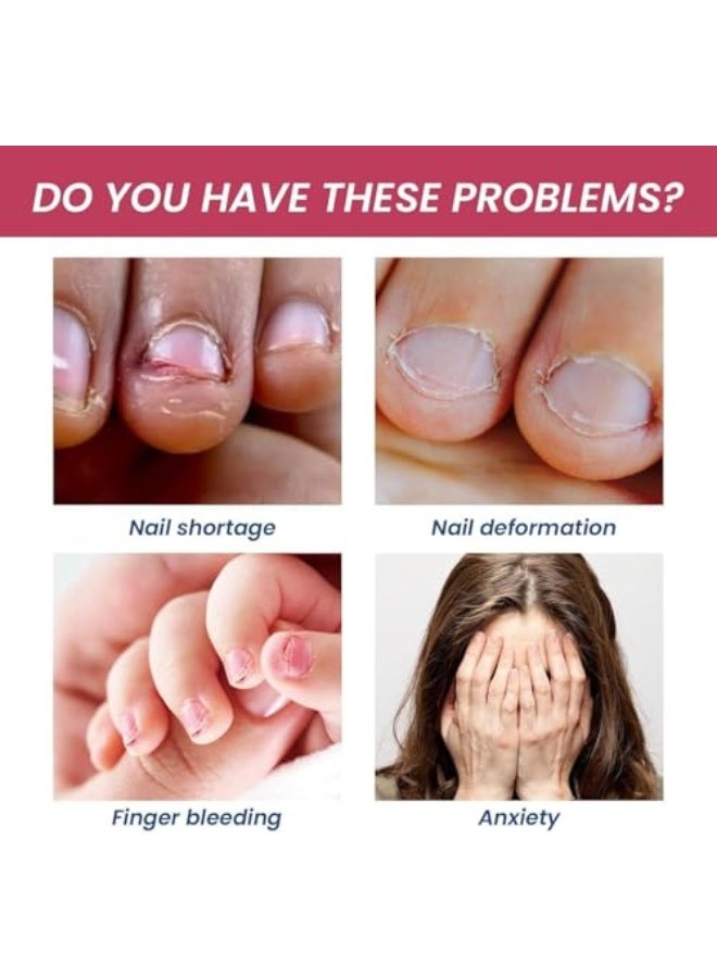 SAUVASINE Anti Nail Biting Polish, Clear Varnish to Discourage Nail Biting and Thumb Sucking for Kids and Adults – Fast Application with Safe, Bitter Taste from Natural Plant Extracts - Image 5