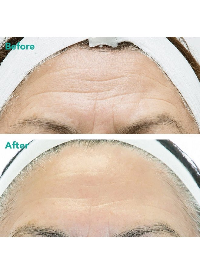 REJURAN - ® Advanced Antiaging Retinol + Cpdrn® Serum For Face And Neck Triple Action With Cpdrn® Retinol And Peptides - Image 1