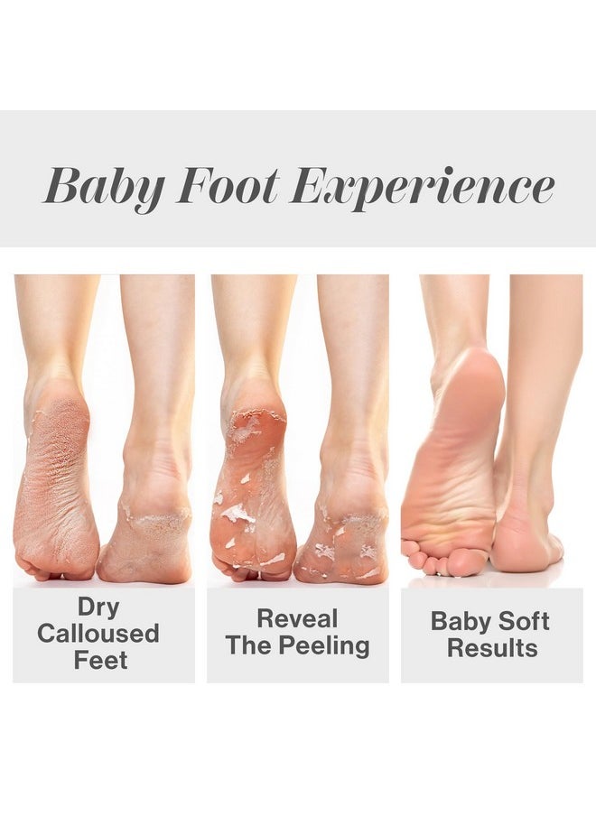 Baby Foot Baby Foot Original Exfoliation Foot Peel - Callus Remover for Rough Cracked, Dry Feet, Dead Skin Removal - Foot Peeling Mask for Baby Soft Feet - Spa Experience at Home & Gift Ideas - Lavender Scented  - Image 4