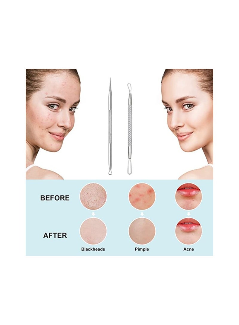 Stainless Steel Pimple Extractor Blackhead Removal Tool Risk Free Treatment for Blemish,Whitehead Popping - Image 5