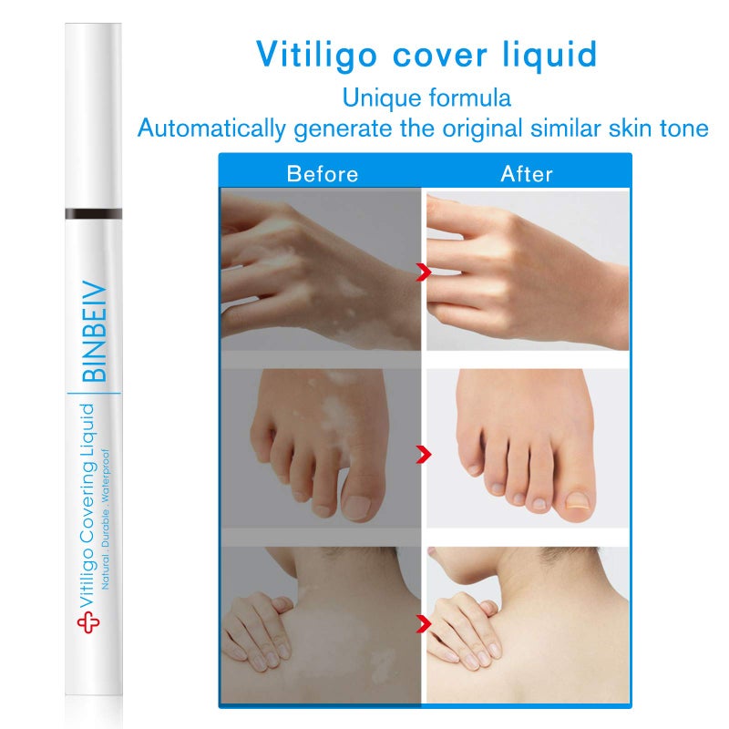 BINBEIV Vitiligo Cosmetic Camouflage Liqui, Cover appearance of Skin Depigmentation, Natural-Durable-Waterproof, Makeup Cover Waterproof, Used on face, hands and body - Image 5