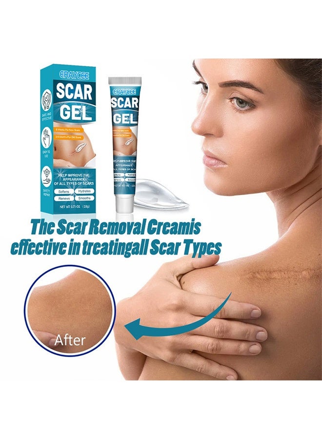 ERAYCEE Scar Gel 20g Effective In Treating Scars C-Section Scars Stretch Marks Acne Surgery Burns Effective On Old And New Scars - Image 2