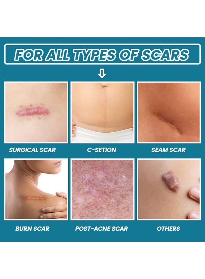 ERAYCEE Scar Gel 20g Effective In Treating Scars C-Section Scars Stretch Marks Acne Surgery Burns Effective On Old And New Scars - Image 5