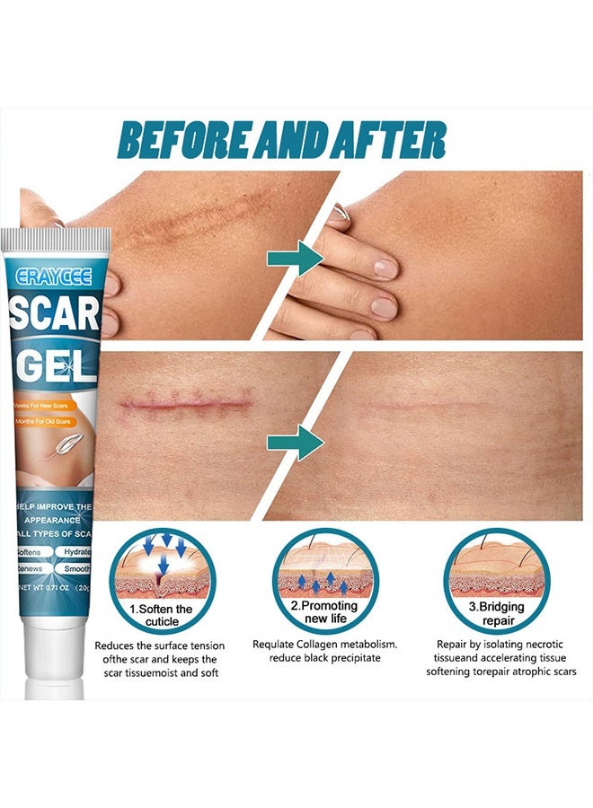 ERAYCEE Scar Gel 20g Effective In Treating Scars C-Section Scars Stretch Marks Acne Surgery Burns Effective On Old And New Scars - Image 4