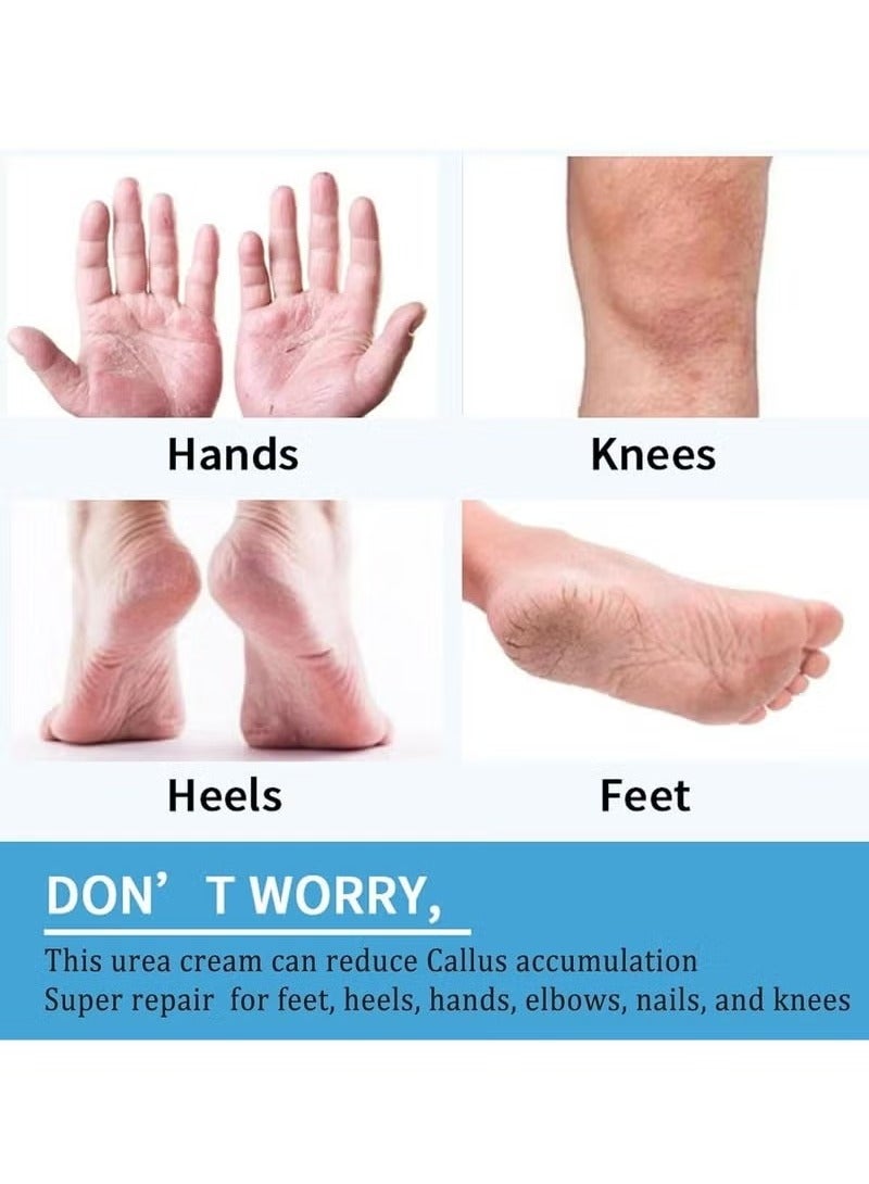 Lanthome Urea Cream 40 Percent For Feet, Foot Cream For Dry Cracked Heels, Foot Callus Remover Cream, 40% Urea Cream For Feet, Organic Moisturizer Cream For Foot, Hands, Legs, Toes - Image 5