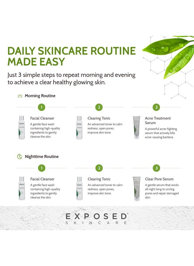Exposed Skin Care - Xposed Skin Care Basic Acne Treatment Kit Includes Salicylic Acid Face Wash Clearing Tonic Treatment Serum With Benzoyl Peroxide Clear Pore Serum Natural Acne Solution For All Skin Types - Image 1
