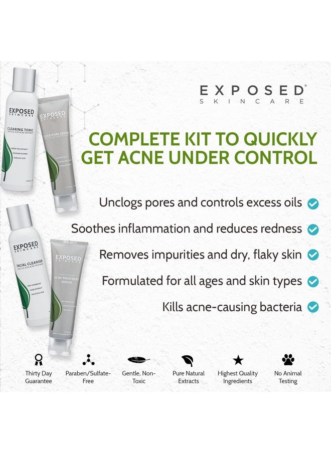 Exposed Skin Care - Xposed Skin Care Basic Acne Treatment Kit Includes Salicylic Acid Face Wash Clearing Tonic Treatment Serum With Benzoyl Peroxide Clear Pore Serum Natural Acne Solution For All Skin Types - Image 1