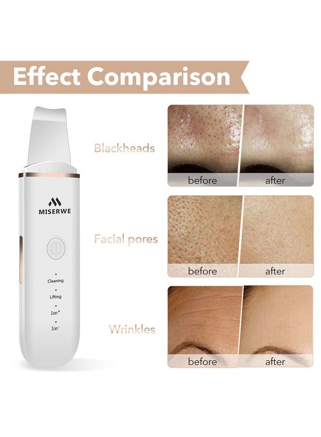 Miserwe Skin Scrubber Face Skin Spatula Facial Scrubber Spatula for Deep Cleansing Blackhead Remover Pore Cleaner with 4 Modes (White) - Image 5