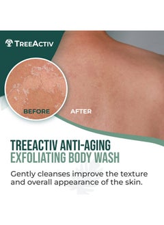 TreeActiv Anti-Aging Exfoliating Body Wash, 8Oz, All Natural Body Wash Women And Men, Exfoliating Body Scrub Infused With Jojoba Beads, Sulfur, And Aloe Vera - Shower Gel For All Skin Types - 50 Uses  - Image 1