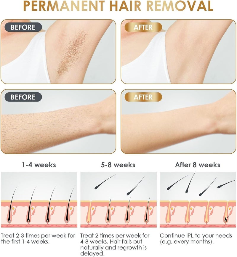 NATRSYM IPL Laser Hair Removal Device for Home Use - Painless Permanent Hair Removal for Face, Body, and Bikini Line - Image 3