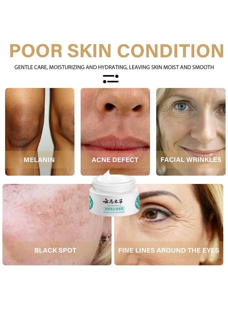 DR. HANCY كريم دكتور هانسي للبقع البيضاء، كريم دكتور هانسي للبقع البيضاء، كريم مصحح للبقع الداكنة، كريم دكتور هانسي للبقع البيضاء في الصين للبشرة الجافة والحساسة (قطعتان) - Image 3