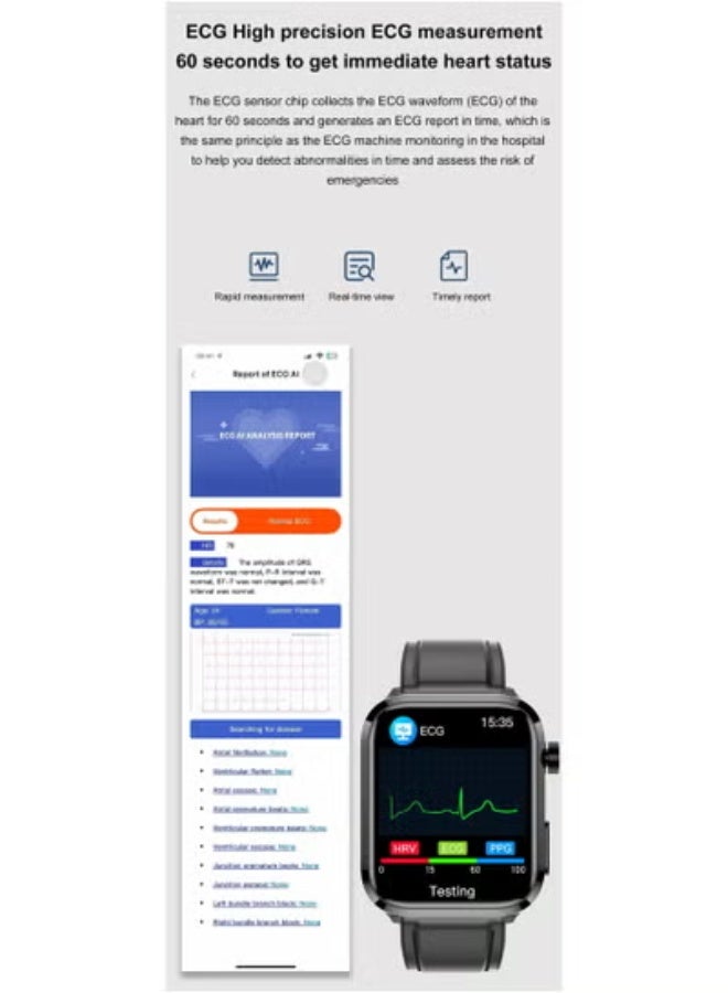 AROAQ New Lipids Uric Acid ,Glucose Smart Watch Men ECG+PPG Fitness Tracker Clock Heart Rate Bluetooth call Smartwatch  - Image 3