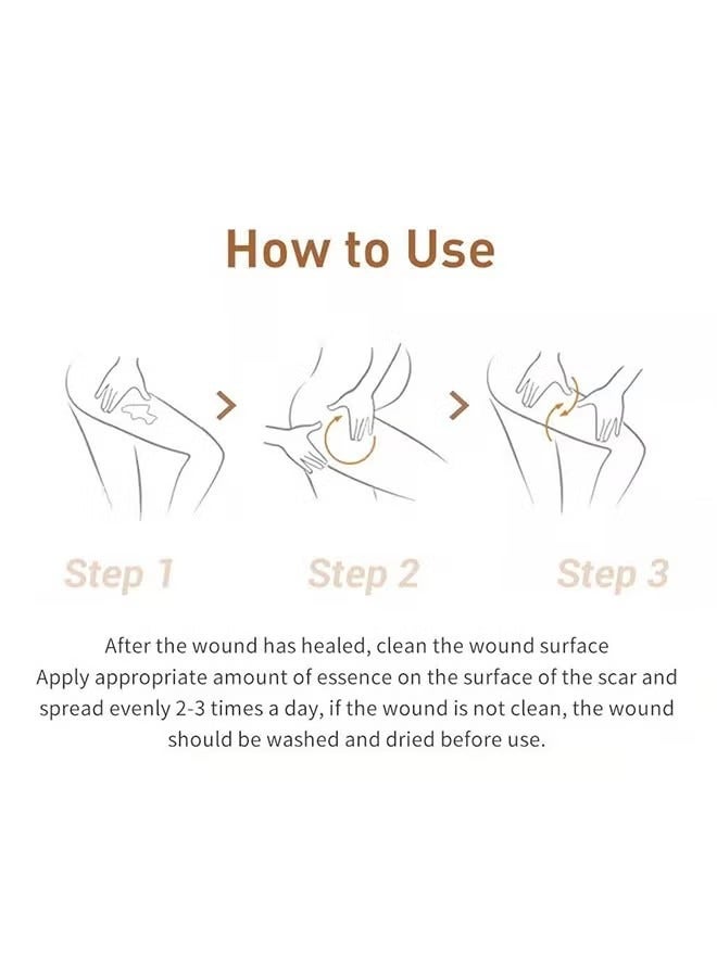 LANBENA مرهم جل لإزالة الندبات وعلامات حب الشباب من تي سي إم، 30 جرام - Image 2