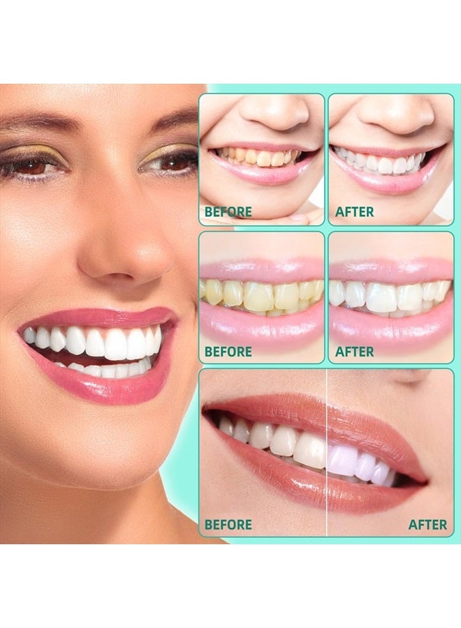 Find Back Coconut Mint Pulling Oil Mouthwash, Natural Teeth Whitening, Ayurvedic Daily Swish for Oral Health, Tongue Scraper Included, Alcohol & Fluoride Free, Healthy Gums, Good Breath, 237ml - Image 5