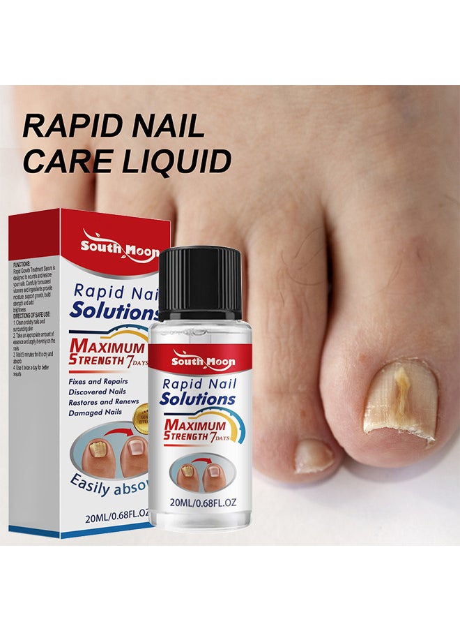 SOUTH MOON - Rapid Nail Care Liquid - Fungal Nail Treatment For Toe Nail And Fingernails For Thick Broken Discolored Nails - Renews Damaged Cracked Ingrown Toenail - Image 1