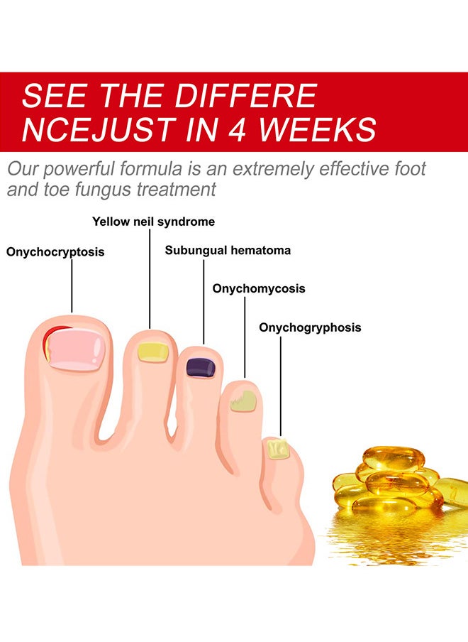 SOUTH MOON - Rapid Nail Care Liquid - Fungal Nail Treatment For Toe Nail And Fingernails For Thick Broken Discolored Nails - Renews Damaged Cracked Ingrown Toenail - Image 1