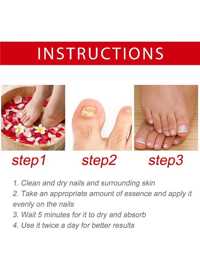 SOUTH MOON - Rapid Nail Care Liquid - Fungal Nail Treatment For Toe Nail And Fingernails For Thick Broken Discolored Nails - Renews Damaged Cracked Ingrown Toenail - Image 1