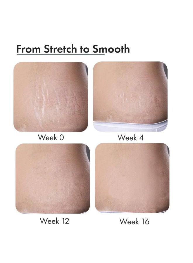 ThriveCo Stretch Marks Expert Serum Cream | Prevents & Reduces Appearance of New (Red) and Old (White) Stretchmarks | Powered by Striover™, Rosehip Oil & Squalane |  30ml (Pack of 2) - Image 3