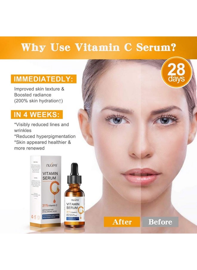 NUSPA - Organic Vitamin C Serum For Face 31% Vitamin C Facial Serum Anti Aging Serum Reduces Age Spots Face Dark Spots Sun Damage Skin Brightening Facial Serums With Hyaluronic Acid And Astaxanthin - Image 1