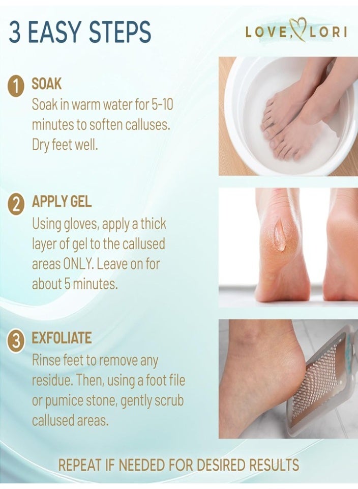 Love, Lori Professional Foot Scrubber Dead Skin Remover Kit - Foot File & Callus Gel Feet Scrubber Scraper Bundle - Image 4