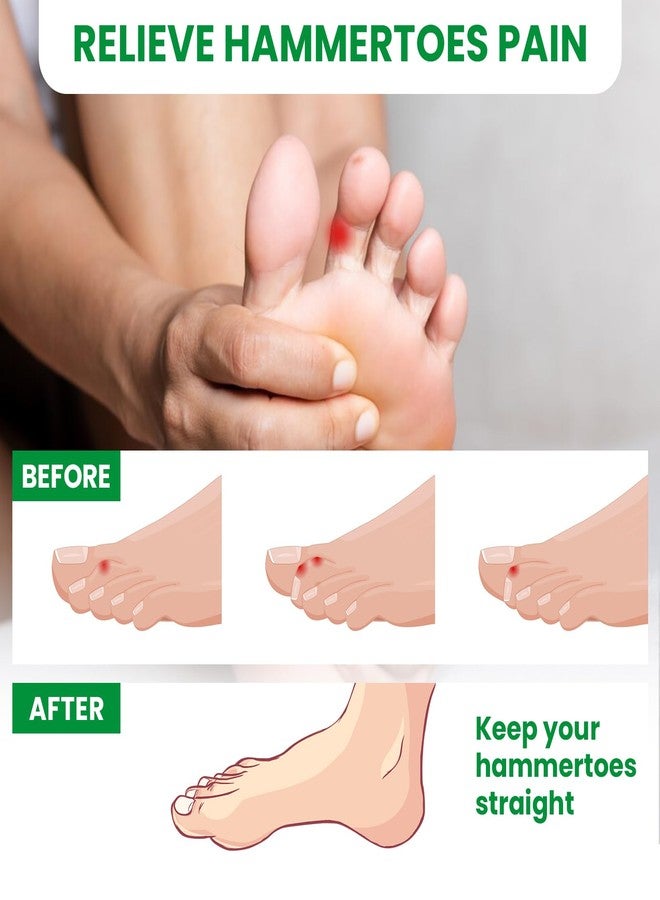 Bukihome Hammertoe Corrector - 6 Count Gel Toe Straighteners and 1 Count Broken Toe Wrap - Realign Bent, Curled, Crooked, Claw, Hammer Toes - Toe Corrector Splints for Men and Women, 4 Different Sizes - Image 3