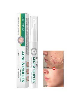 JoyPretty Acne and Pimples Treatment Cream, Anti-Acne Facial Cream for Repairing and Soothing, Effective Acne Treatment Ointment for Unisex, 15g  - Image 1