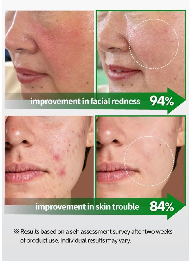 BEAUDIANI Cica Ampoule Mask 100ea, Skin care pad, Korean toner pads, Centella asiatica toner pad, Hydrating toner pad, facial essentials, Quick Calming, Reduce Hot flush, nutrition for irritated skin - Image 5