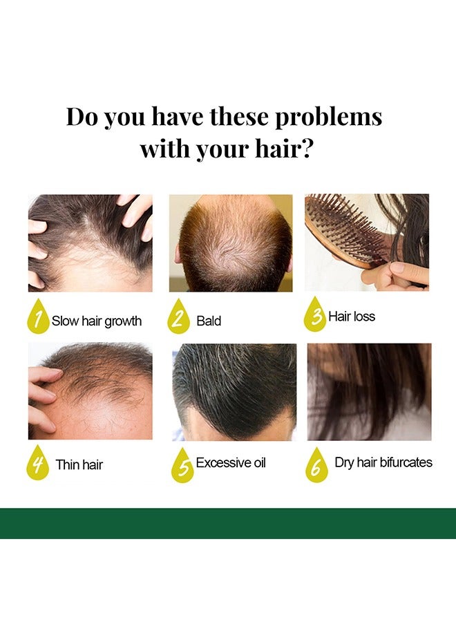 EELHOE King Of Ginger-7Days Ginger Hair Nutrient Solution Ginger Germinal Oil,Ginger Essential Oil Stop Hair Loss Hair, Thinning Treatment Hair Growth Oil For Women & Men 50ml - Image 4