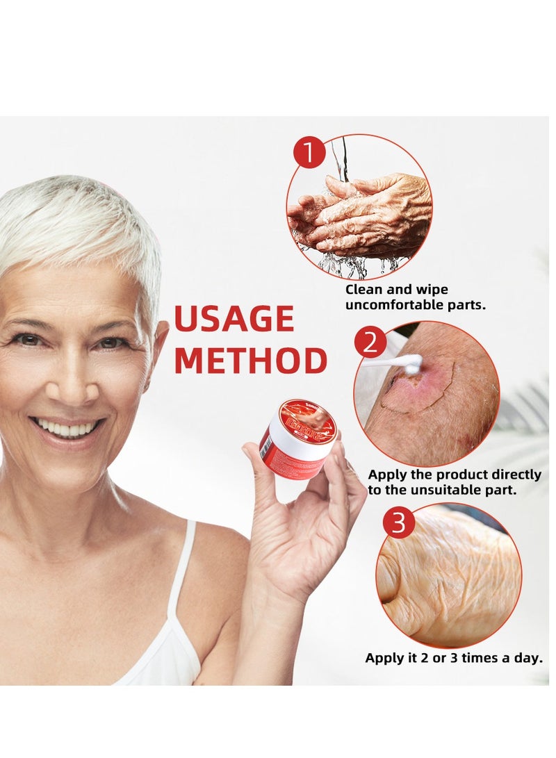 سوميفون كريم لعلاج قرح الفراش، سريع المفعول لعلاج قرح الفراش، فعال في علاج قرح الفراش - Image 4