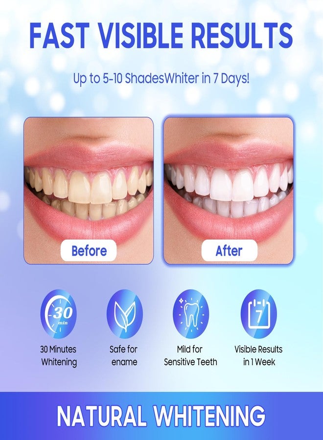 luanerl Teeth Whitening Strips 56 Strips (28 Treatments,Peroxide & Sensitivity Free,Enamel Safe with Soothing Natural Ingredients for Deep Stains Removal - Image 5