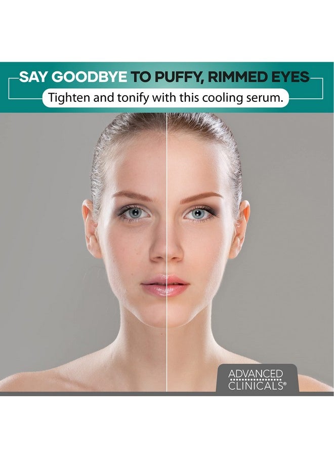 Advanced Clinicals - Puffy Eyes Treatment Eye Serum Anti Aging Brightening & Firming Under Eye Serum With Vitamin E Collagen Gotu Kola Caffeine & Green Tea Helps Hydrate & Calm Puffiness 2Pack - Image 1