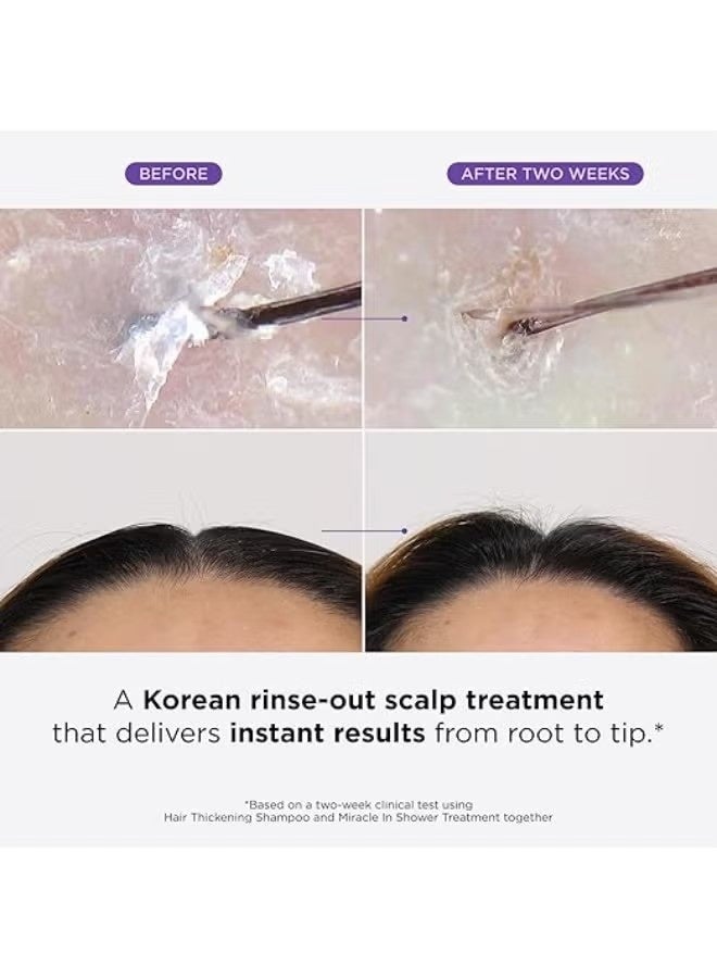 دكتور جروت الدكتور غروت معجزة في العلاج بالدش لتساقط الشعر, العناية بالشعر الكورية, 5 ثواني لتناعم الشعر, زيت الروزمري للشعر الأكثر صحة, شطف الشعر, علاج ترطيب, حل تنشيط فروة الرأس - Image 3