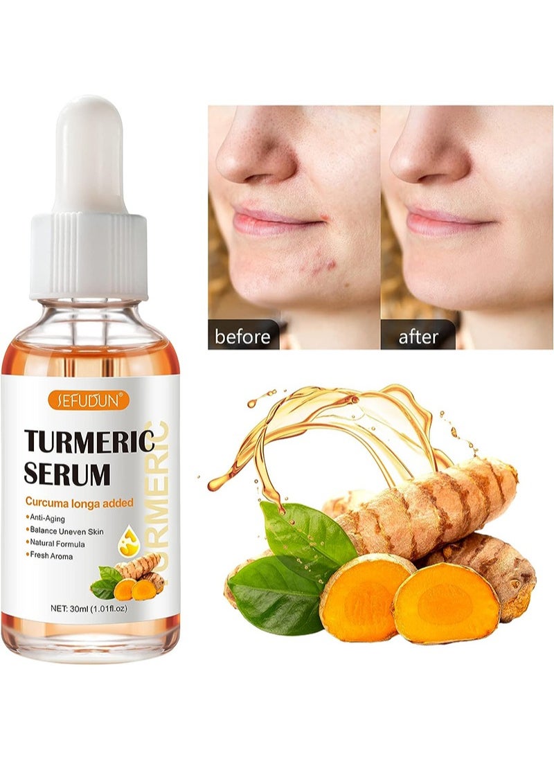 Sefudun Turmeric Dark Spot Serum 30ml, Dark Spot Correcting Serum for Face and Body, Reduces Hyperpigmentation, Age Spots, Sun Spots and Improves Skin Tone for Women and Men of All Skin Types  - Image 1