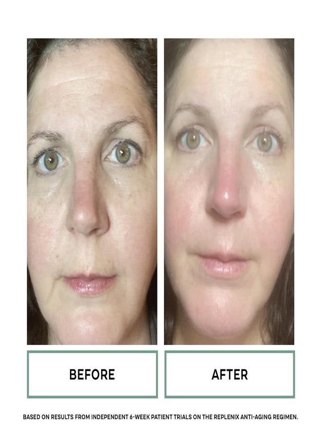 Replenix Growth Factor Restorative Facial Serum, Anti-Aging Treatment with Medical-Grade Ingredients for Mature Skin (1 fl. oz) - Image 5