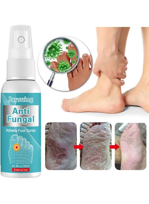 Anti Fungal Athletes Foot Treatment Spray, Efficiently Controls Itching and Inflammation on the Feet, Cures and Prevents Fungal Infections, for Athlete's Foot, Foot Sweat and Foot Odour, 50 ml