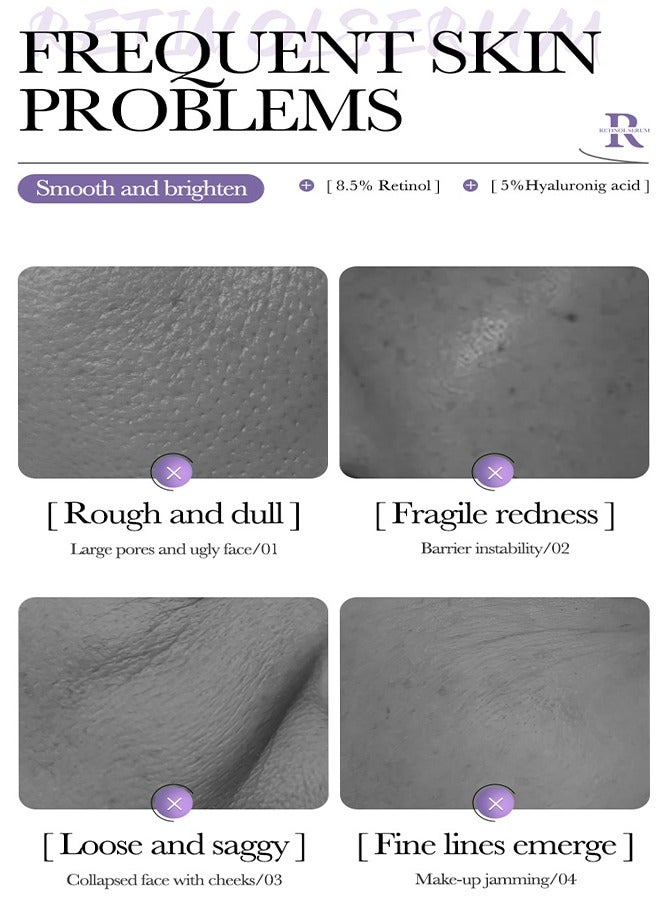 BIOAQUA Retinol Serum - Facial Serum Anti-Wrinkle Tender Skin 8.5% Retinol 5% Hyaluronic Acid Moisturizing Essence 30ml - Image 4