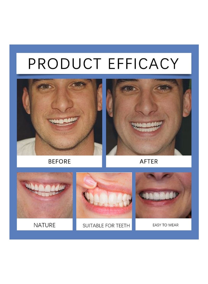 أورالحوي أسنان السيليكون والأدوات ومجموعات ترميم الأسنان المؤقتة المريحة تعزز جمالية الابتسامة مع الأدوات - Image 4