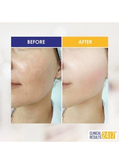 Increase Skin Hydration 161% and Firm Skin from the Lower Layers with 3D Lift PGA Serum | NASA Stem Cell & Growth Factor Technology Visibly Reduces Wrinkles |Clinical Results 24|7 -8 Week Supply (1oz)