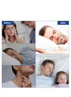Elaimei ELAIMEI Anti Snoring Sleep Strips Disposable Mouth Strips Tape Reduce Mouth Dryness Sore Throat Snoring Solution 90pcs  - Image 5