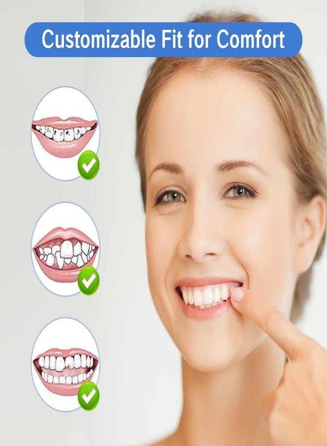 YAFIYGI 2 Pairs Teeth Covers with Top and Bottom Fake Dental for Broken or Missing Teeth Snap-On Confidence Smile Fake Dentures for Men Easy-to-Use Smile Enhancement Covers and Storage Box - Image 4
