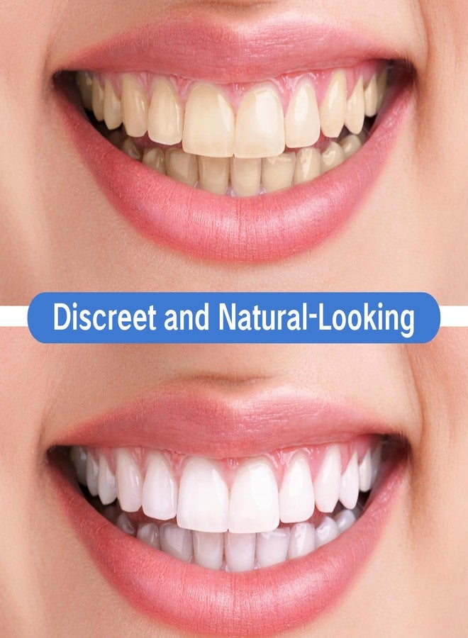 YAFIYGI 2 Pairs Teeth Covers with Top and Bottom Fake Dental for Broken or Missing Teeth Snap-On Confidence Smile Fake Dentures for Men Easy-to-Use Smile Enhancement Covers and Storage Box - Image 5
