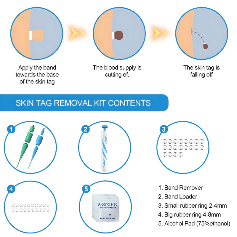 Acrochordons Treatment, Acrochordons Removal Kit 2-8mm Suitable for all Body Parts Safe and Easy to Use - Image 5