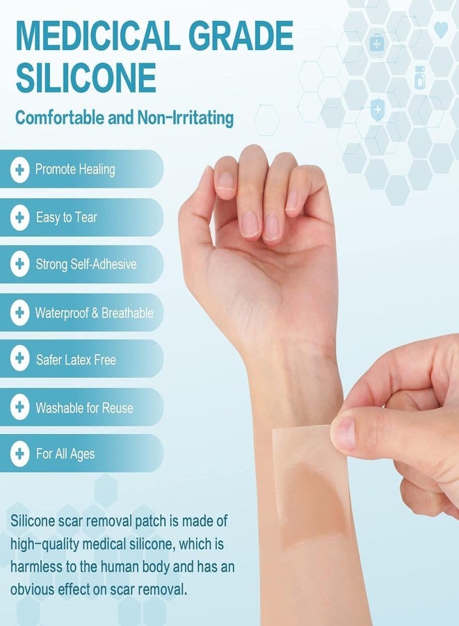 SAMTA ENTERPRISE Samta Silicone Scar Sheets (1.6”x60”Roll-1.5M), Silicone Scar Tape, Reusable Scar Removal Sheets for C-Section, Surgery, Burn, Keloid, Acne - Image 2
