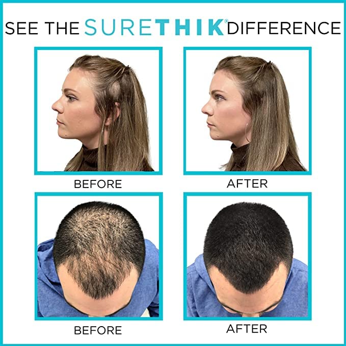 SureThik Hair Thickening Fibers 30g with Fiber Holding Spray and Applicator Hairline Comb Black - Image 5